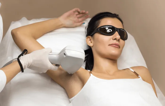 Laser hair reduction treatment