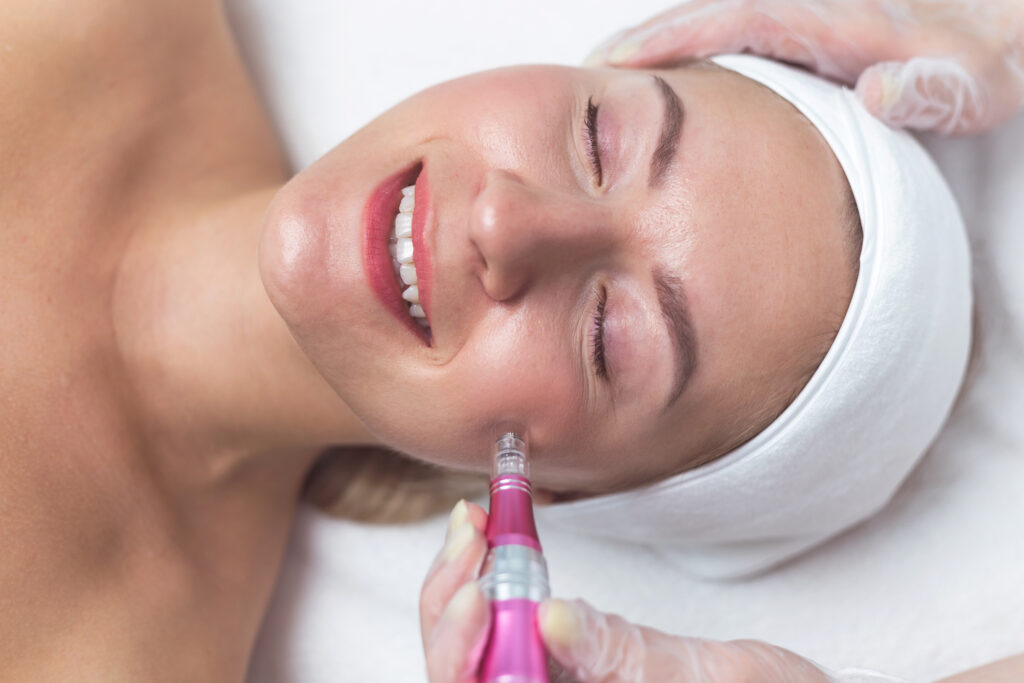 PRP facial at Dr. Bhinder Clinic